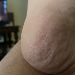 Meet your Posher, Junior felix